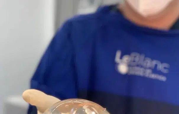 Mamoplastia de Aumento Dr Julian Pacheco